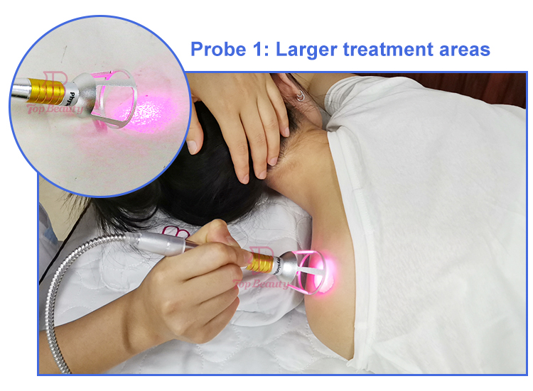 980nm Laser Class 4 Therapy Physiotherapy Cold Laser Healing Machine