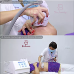 1,000,000shots 8D Ice Cooling HIFU 5D Smas Lifting Ice Skin Care Beauty Machine