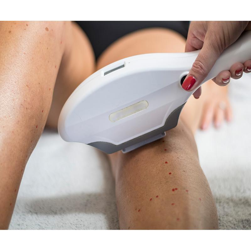 New type intense pulsed light therapy IPL hair removal machine